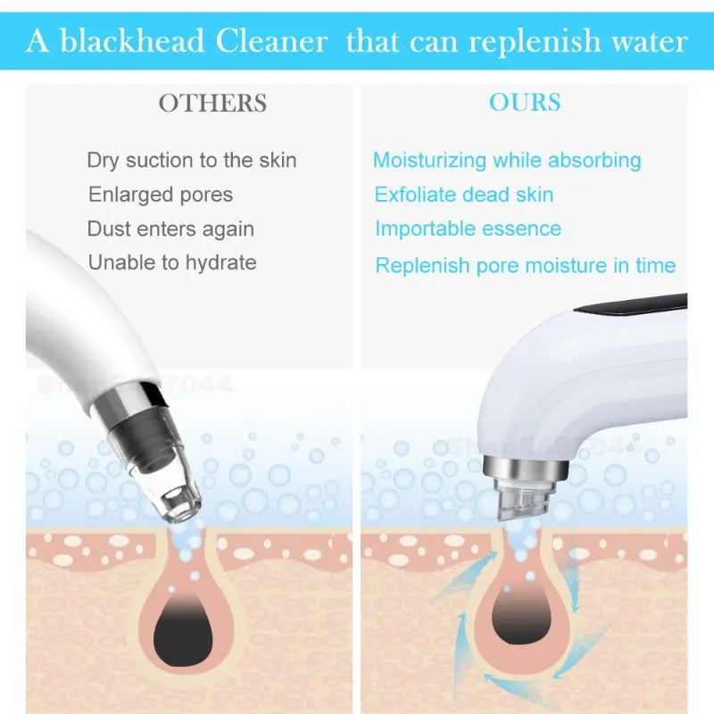 Facial Vacuum: Blackhead & Pimple Extractor