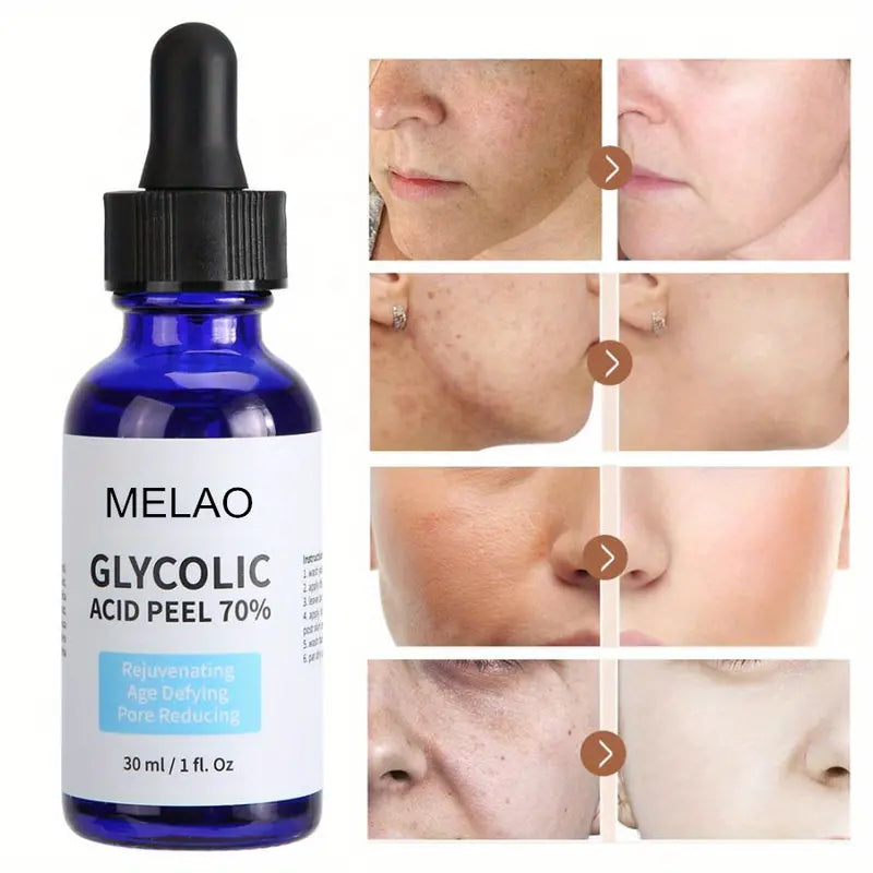 Glycolic Acid Serum: Skin Revitalizer